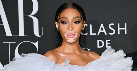 winnie harlow net worth|Winnie Harlow: Parents, ANTM, Boyfriend & Net Worth